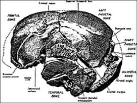 Anatomical labels of the fragmentary remains of the Piltdown Cranium